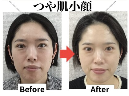 ブプラ 加古川店(BUPURA)の写真