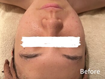 ダイヤモンド リーエンダ(Diamond leende)/クレイハーブピーリング