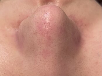 ウェクシー(WECXII)/