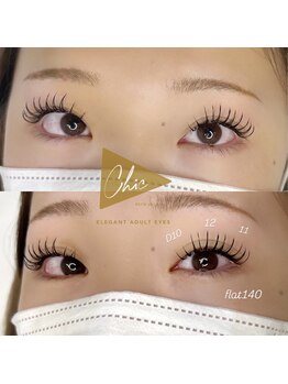 シック(Chic)/フラット140本