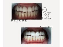 とぅるりん 肌質改善/お試しあれ★一回で驚きの白さ！