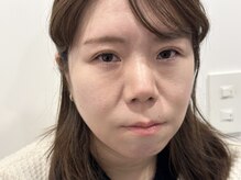 トミー(Tommy)/まつ毛パーマ