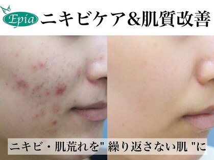 エピア 豊橋店(Epia)の写真