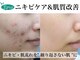 エピア 豊橋店(Epia)の写真