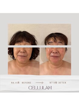 セル ノ ネ(Cell ne)/お目元のお悩みにも!