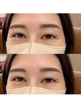 アンリミテッド(Unlimited)/セットメニュー