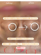 シツ(SHITSU)/REVI 続けることの大切さ