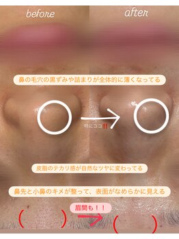 シツ(SHITSU)/REVI 続けることの大切さ