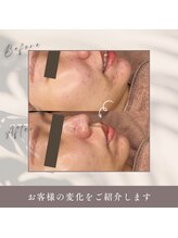 ミーバイ ミッシェル(me'by michelle)/ララピール