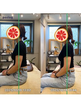 グレフル鍼灸接骨院 整体院 心斎橋/整体/肩こり/マッサージ/腰痛