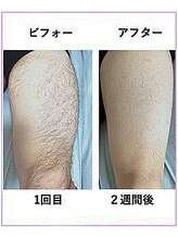 シンバ 南草津店(SIMBA)/☆ ビフォーアフター ☆