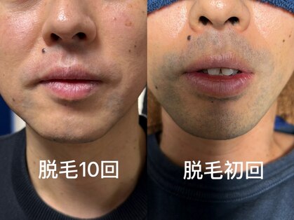 シェービーズ(shavys)の写真