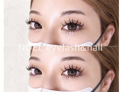 ノエル(NOEL)の写真