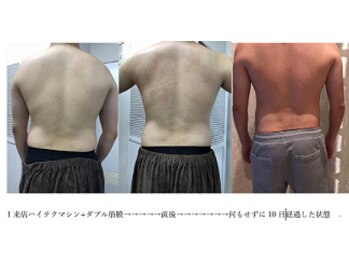 スキャニング@ラボエステ/腹腰背中痩身1来店だけの効果