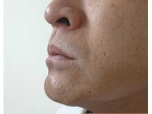 マホラ 高崎駅東口店(Mahora)/メンズもすべすべ肌♪