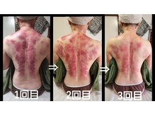 オアシス(OASIS)/ホット★カッサ