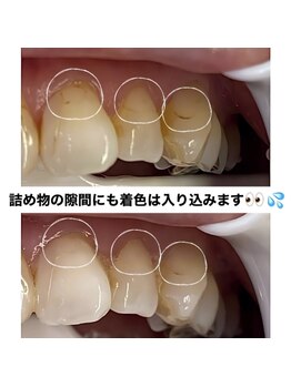 リトリート(Retreat)/ホワイトニング