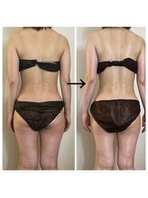 リオラ ビューティー(Liora beauty)/《before/after》