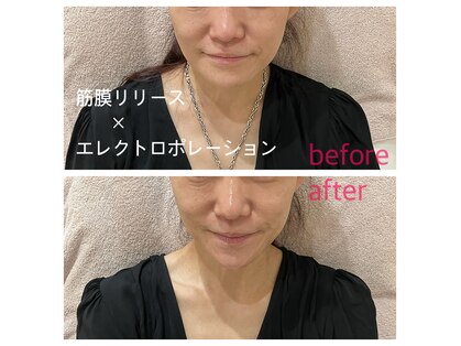 ヴォートル中野 ネイル まつげエクステの写真