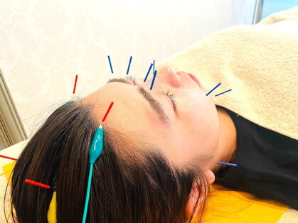 スイッチオン接骨院 はり灸院の写真