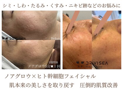 ビーズスタイル(B’S STYLE)の写真