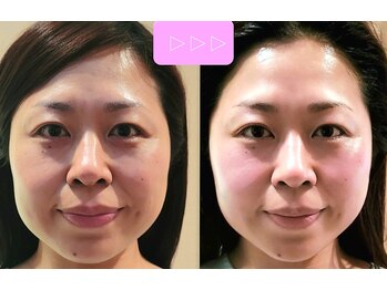 楓整骨院/50・60代も多く通われています♪