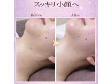 武蔵小杉リンパサロン かおりの部屋の雰囲気（小顔筋膜リリースで、理想のフェイスラインへ）