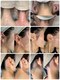 エステリア 蒲田の写真/もっと早く知りたかったとのお声多数！ダブル脱毛で即ツル＋減りの速さ◎