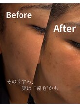 ジョエルワックス 沖縄那覇店(JOELLE WAX)/その顔のくすみ、実は産毛かも