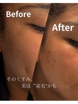 ジョエルワックス 沖縄那覇店(JOELLE WAX)/その顔のくすみ、実は産毛かも
