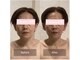 ケービューティー 小顔(K-beauty)の写真