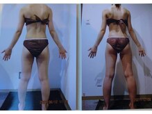 パーフェクトボディプレミアム 名古屋駅前店(PERFECT BODY PREMIUM)/お客様　ビフォーアフター（23）