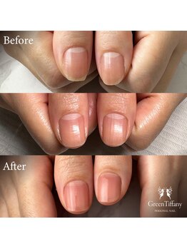 グリーンティファニー 麻布十番(Green Tiffany)/ビフォーアフター1回