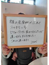 ナチュラルハリー(NaturalHarry)/【口コミ】経絡小顔