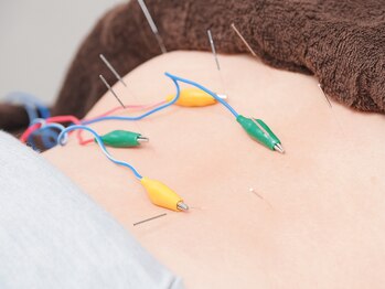 トラスト整骨院鍼灸院/鍼灸で深部にアプローチ☆