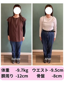 パンダ(Panda)/美骨鍼灸ダイエット