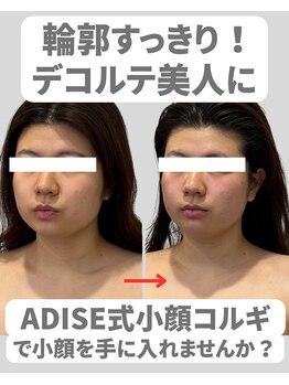 アディス 心斎橋(ADISE)/ADISE式コルギで輪郭すっきり！