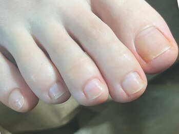 ユキネイル(YUKINAIL)の写真/【巻いたお爪】のお手入れ、大事です！