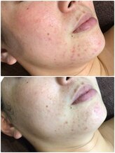 クレビア(CREBIA)/