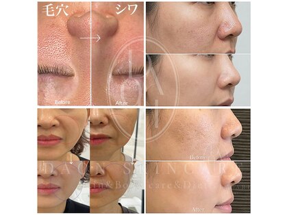 多穏スキンケア(skin care)の写真