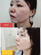 縁(en)/レモンボトル一回の変化
