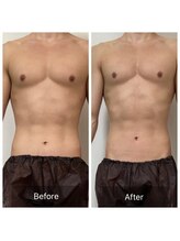 アリッチ 岡崎店(a.Rich)/筋肉のカット出しも得意です☆