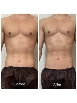 アリッチ 岡崎店(a.Rich)/筋肉のカット出しも得意です☆