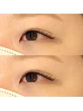 ヌナ(nuna)/マットフラットラッシュ140本