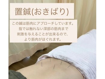 れんげ鍼灸整骨院/【京橋】鍼灸施術/腰痛改善