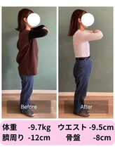 パンダ(Panda)/美骨鍼灸ダイエット