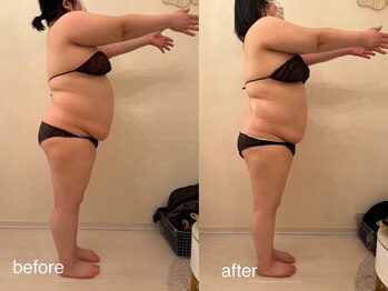 クロレ 浦和店(CLORE)/30代のお客様/8回施術