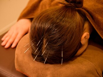 ジネコラボ 海老名(Gyneco-labo)/大人気！頭スッキリ！頭皮鍼