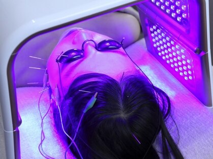 ラビィ(lovie)の写真