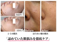 リシェス(Richesse)の雰囲気(諦めていた肌悩みを徹底ケアし、自信が持てる輝く素肌へ導きます)